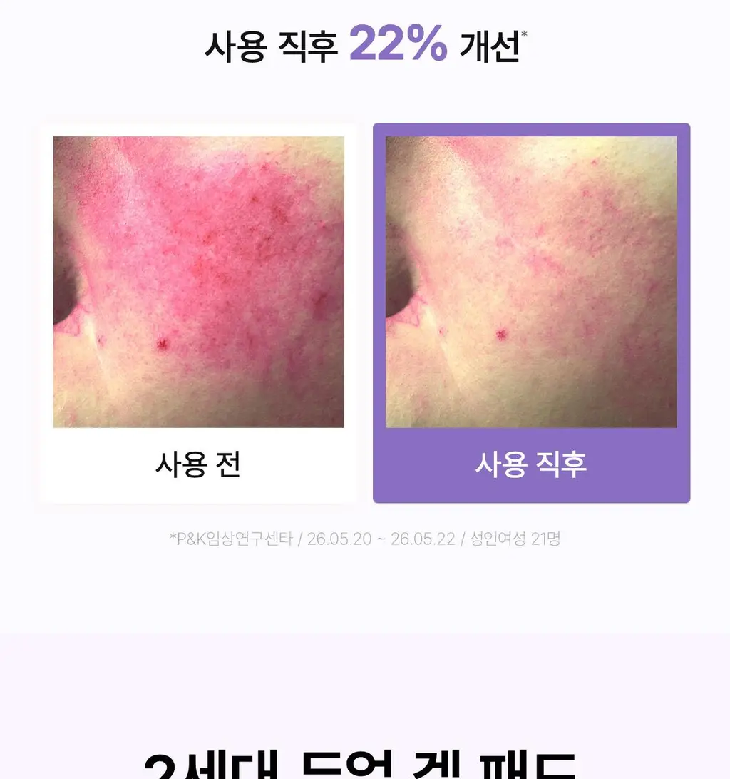 [NEW/양면겔패드] 바이오던스 캐비어 PDRN 듀얼 겔 토너 패드 60매 상세페이지 11